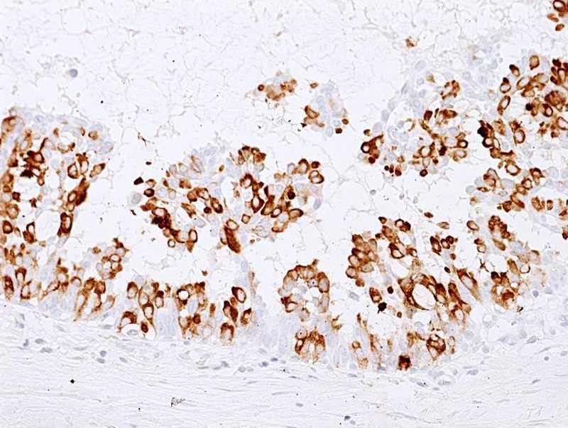 Figure_14b