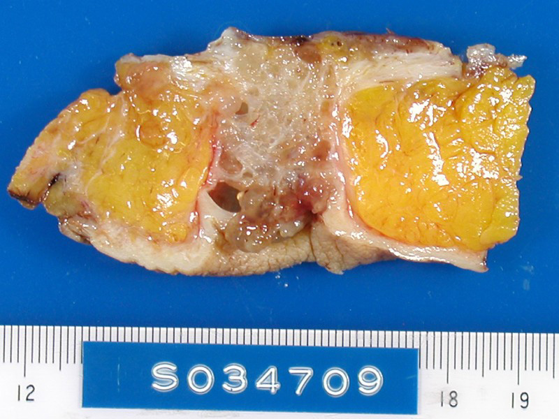 Figure_16a