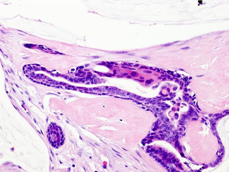 Figure__5b
