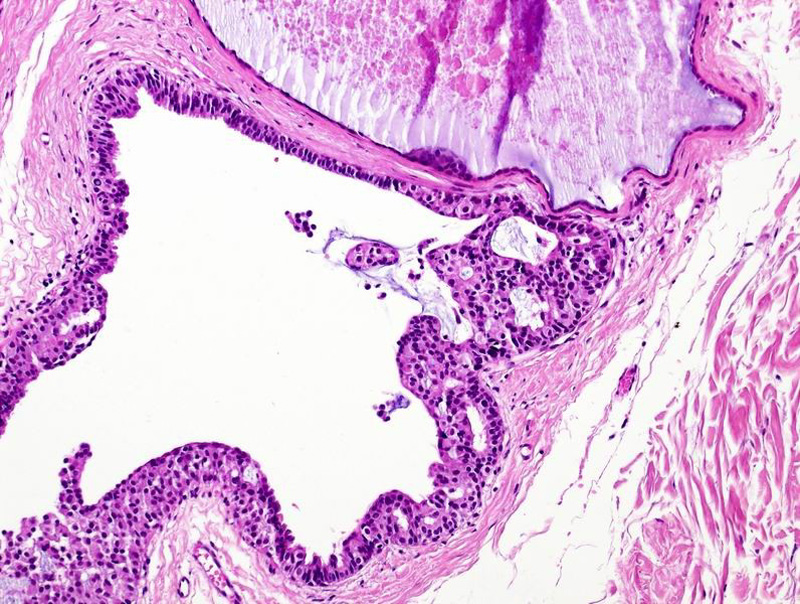 Figure__6b