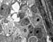 Figure_15d