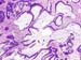 Figure_17a